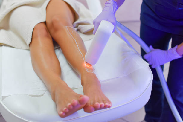 laser hair removal Utah